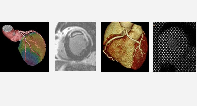Curso de Imágenes Cardiovasculares no invasivas